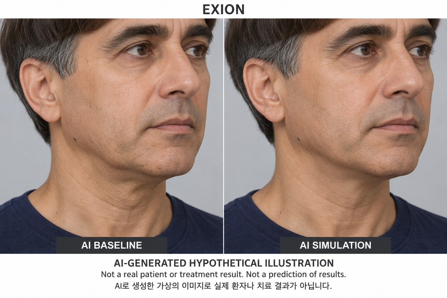 Fictional AI illustration; not an actual patient, result or prediction — EXION