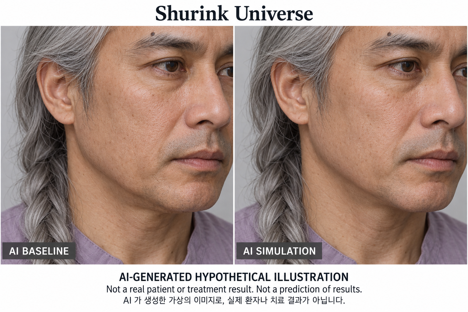 Fictional AI illustration; not an actual patient, result or prediction — Shurink Universe